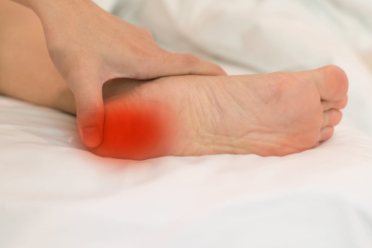 פלאנטר פאשאיטיס "דורבן" -  Plantar Fasciitis