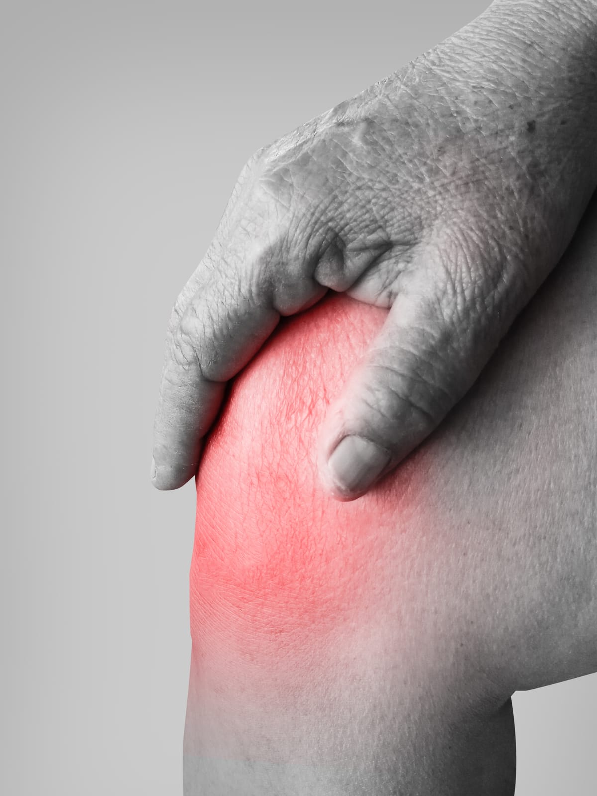 דלקת מפרקים שגרונית (ראומטואיד ארטריטיס ,Rheumatoid Arthritis, RA)  