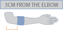 אפיטק פיקס - טניס אלבו EPITEC FIX אפיטק פיקס - טניס אלבו EPITEC FIX